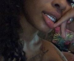 💕💕💕💦Exotic Black&Hawaiian Head Doc 💦💕💕💕 - 3